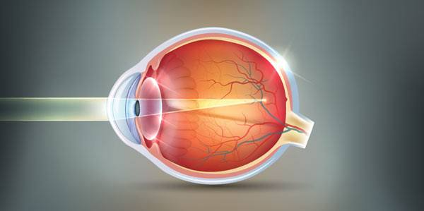 Myopia Treatment Options: Glasses, Lenses, and Surgery
